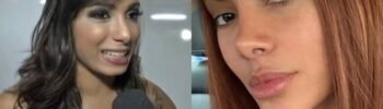 Antes e depois de Anitta