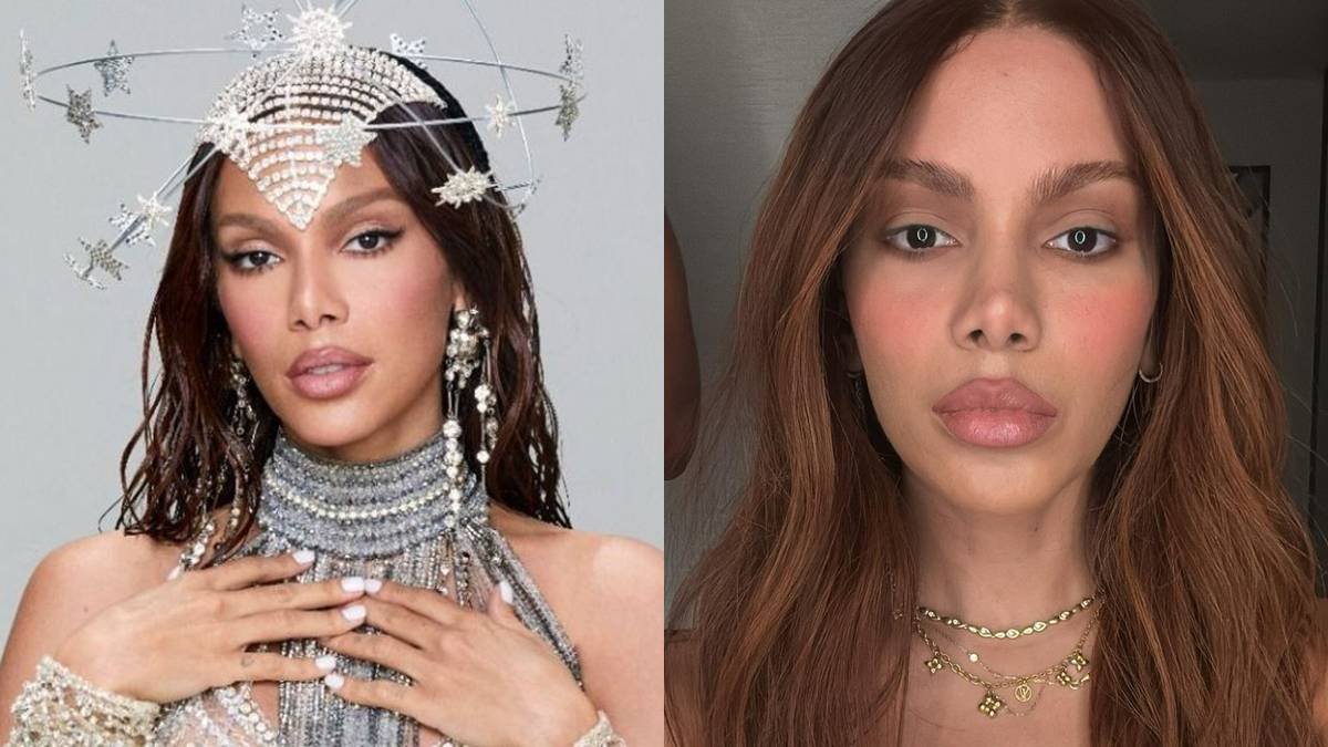 Anitta após plásticas